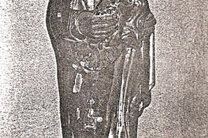 1974 (4)